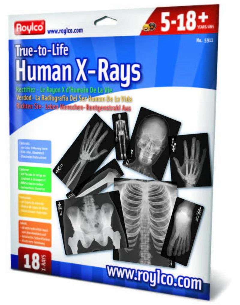 True To Life Human X-Rays®, 18/pkg